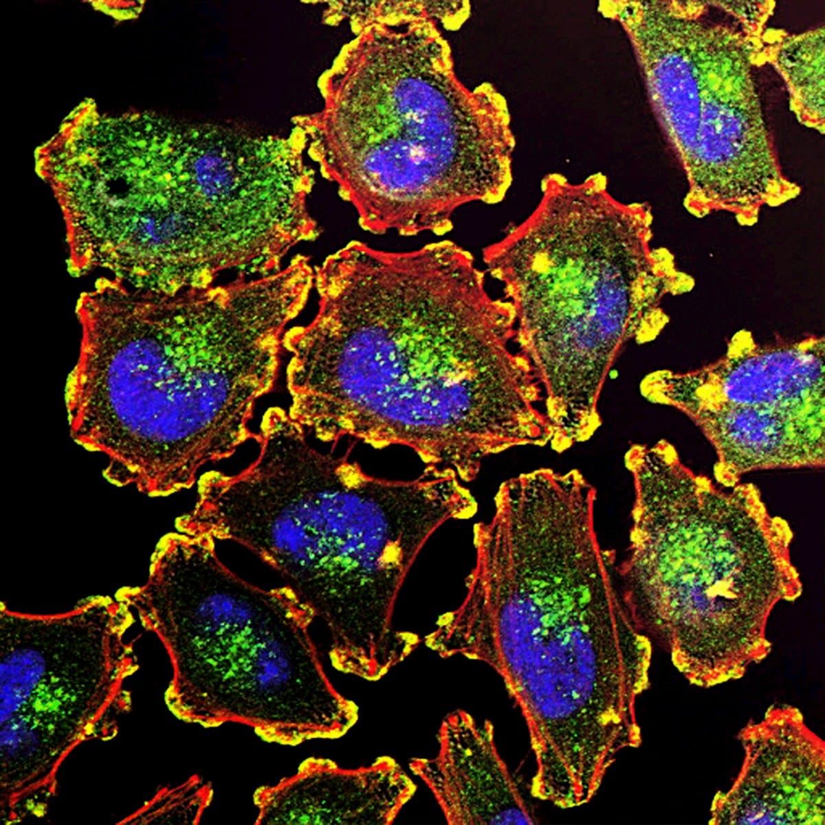 Microscopy and laboratory equipment for cell death pathway research