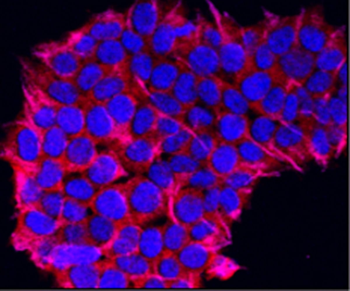Necroptosis and EBC-46: The RIPK1/RIPK3/MLKL Pathway in Tigilanol Tiglate Cell Death