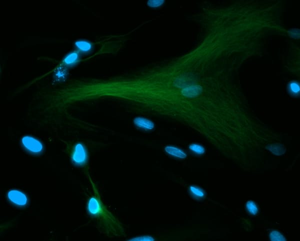VEGF Suppression and EBC-46: How Tigilanol Tiglate Affects Tumour Angiogenesis