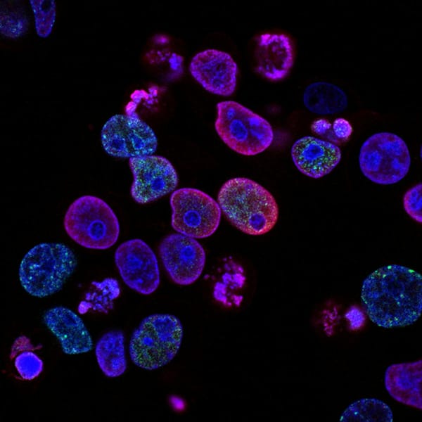 How EBC-46 Disrupts Tumour Vasculature: The PKC-Delta to Endothelial-Damage Cascade