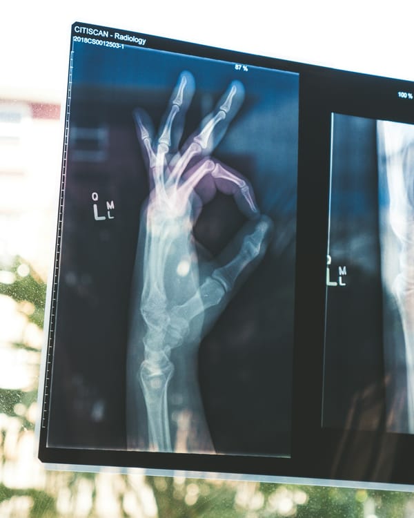 MRI as a Response Biomarker in Tigilanol Tiglate Clinical Trials